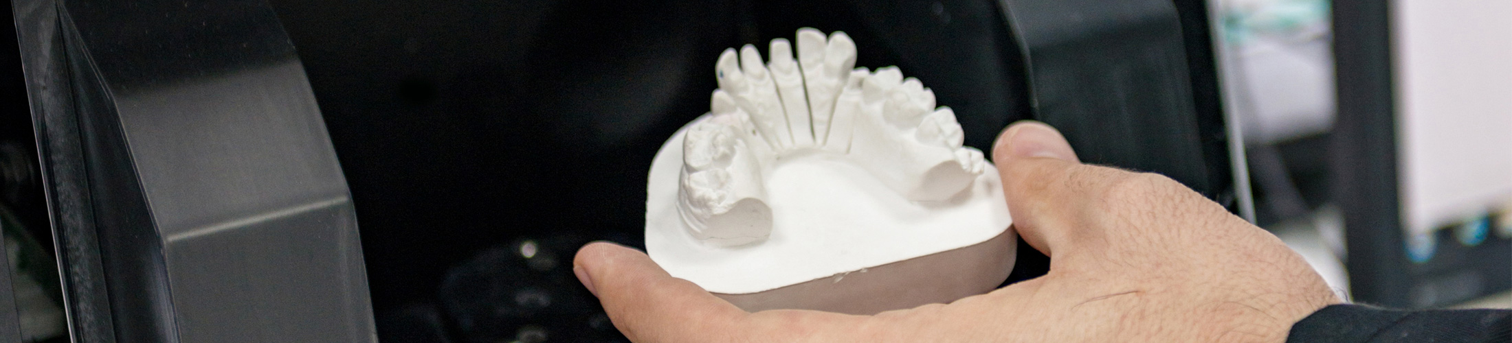 CAD/CAM scanner - Dental Laboratory in Bolton