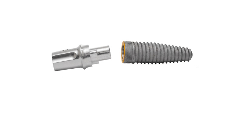 Dental Implant - Dental Laboratory in Bolton